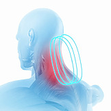 مرخٍ للعضلات